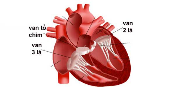 Bệnh hẹp van hai lá: Nguyên nhân, triệu chứng và phương pháp hỗ trợ điều trị tại nhà